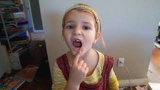 She broke her tooth again... Vlog #78