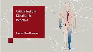 Critical Insights: Distal Limb Ischemia