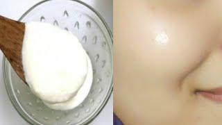 How to remove dark spots, marks and blackness on the skin with curd? Curd for skin whitening