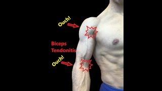 Biceps Tendonitis | Exercises For Myofascial Release
