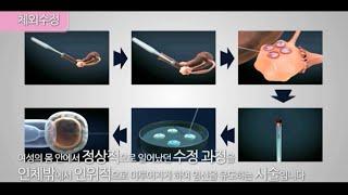 [난임시술] 시험관 아기 시술 (서울의료원 가임센터) ⓒ한국 머크 #난임치료 #난임센터 #시험관아기 #인공수정 #난임시술 #난임