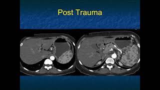 You Make the Call! Freestyle Radiology Quiz #16