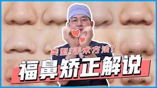 【韩国爱她】 DO鼻尖, 你是福鼻吗？福鼻矫正解说大公开