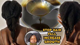 My hair is not growing and it’s falling out | How to stop hair fall & Increase growth at home