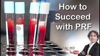 HOW TO EXCEED WITH PRF FACE INJECTIONS-Dr Rajani