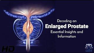 Enlarged Prostate Explained: Symptoms, Causes, and Treatments