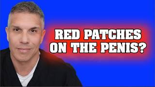Red Patches On The Penis? Zoon's Balanitis Reviewed