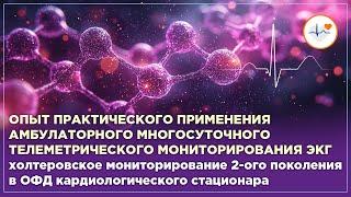 Опыт практического применения амбулаторного многосуточного телеметрического мониторирования ЭКГ