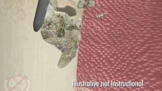 Laser Gum Disease Treatment Fort Lauderdale, FL | Dr. Sawan Malik
