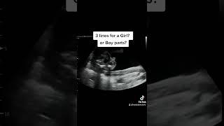 Gender Reveal Ultrasound at 22 Weeks 3 Days Pregnant