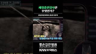 세침흡인검사란 무엇인가?