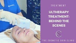 Ultherapy Treatment: Behind The Scenes | The Cosmetic Skin Clinic