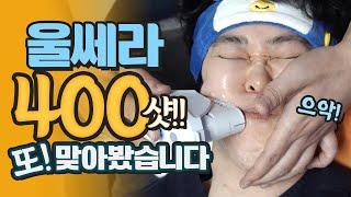 너무아픈 울쎄라 400샷 또 맞아봤습니다.