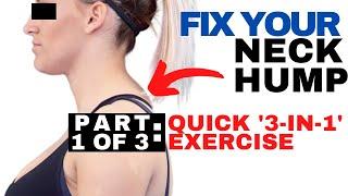 QUICK Fix for Neck Hump | Dowager's Hump Fix | How to Get Rid of a Neck Hump