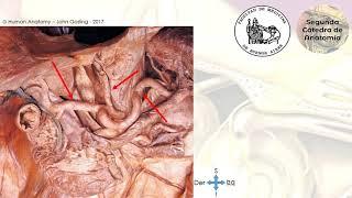 E3.2 | Vascularización de abdomen supramesocólico | Anatomía 2 | FMed UBA