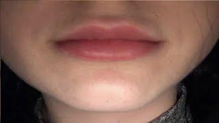 how to get rid of mustache shadow female