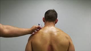 Neck Cupping Variations