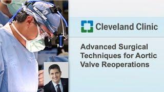 Advanced Surgical Techniques for Lifetime Management of Aortic Valve Disease with Dr. Eric Roselli