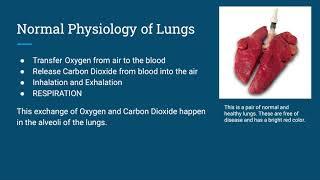 Cystic Fibrosis- Allison Bartlett