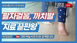 [탑팀LIVE] 팔자걸음, 까치발 치료 끝판왕 / 탑팀재활의학과 박정욱