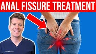 10 Tips to Help With Anal Fissure Symptoms