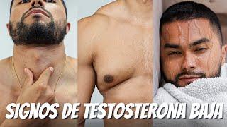 6 Signos De Testosterona Baja