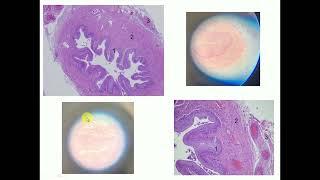 Histology slide identification: Ureter - By Dr Mitesh Dave