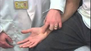 Ulnar Compression Test