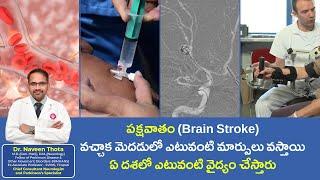 Phase Wise Treatment of Stroke | Dr Naveen Thota