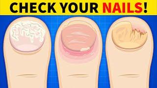 5 Things Your Nails Can Tell You About Your Health