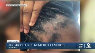 Mom pulls 11-year-old girl out of school after boy rips her hair out