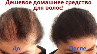 Находка для волос! Простой способ укрепить волосы и стимулировать рост волос! Маска для волос.