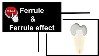 Ferrule and ferrule effect | Tooth preparation| Prosthodontics| Endodontics| Dental tuition.