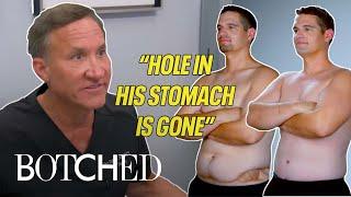 UNBELIEVABLE Botched Life Changing Transformations (BEFORE & AFTERS) | Botched | E!