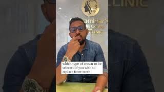 #shortsOne Minute With Dr Varun Nambiar|Epi 3|What Type of Crown You Should Select for AnteriorTeeth