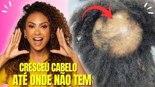 SEGREDO JAPONÊS! APENAS 2 INGREDIENTES PODEROSOS  O CABELO CRESCE INCRIVELMENTE RÁPIDO