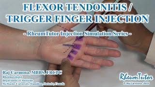 FLEXOR TENDONITIS / TRIGGER FINGER INJECTION - Simulation Series