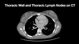 Anatomy of the Thoracic Wall and Thoracic Lymph Node Stations on CT