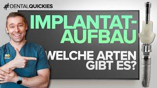 Implantataufbau / Abutment - Was ist das? Welche Arten von Abutments gibt es? Wozu dienen Abutments?