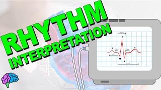 The Complete ECG Rhythm Interpretation Series!