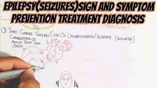 Epilepsy(Seizures)Sign And Symptom Prevention Treatment Diagnosis @umerfarooqbiology7083