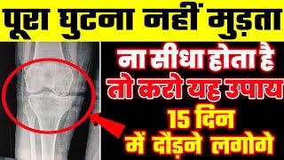 घुटना पूरा नहीं मुड़ता तो करें यह एक्सरसाइज|Knee Pain Exercises|Knee Gap Exercises