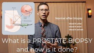 Prostate biopsy procedure explained by urologist