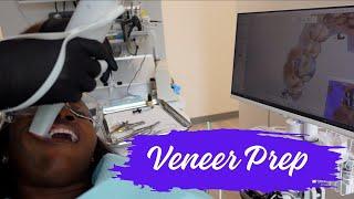 Prepping for composite veneers | #adultbraces