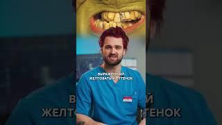  Разбор зубов Гринча. Советы от детского стоматолога