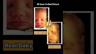 4D Baby Scan Vs Real Life  #baby #ultrasound #real