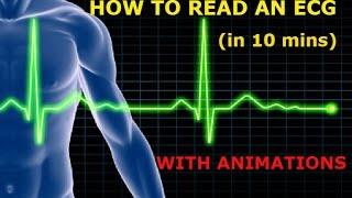 HOW TO READ AN ECG!! WITH ANIMATIONS(in 10 mins)!!