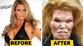 45 Celebrity Plastic Surgery Disasters