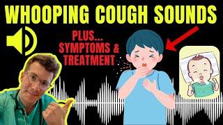 Doctor explains WHOOPING COUGH plus examples of REAL SOUNDS | Symptoms, diagnosis, treatment & more!