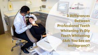 3 Differences Between Professional Teeth Whitening Vs Diy Teeth Whitening